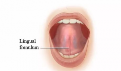 什么是舌系带，有什么影响