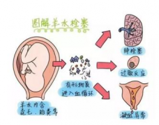 羊水栓塞急救演练，筑母婴堡垒，为生命护航