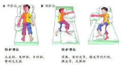 预防压疮的健康宣教